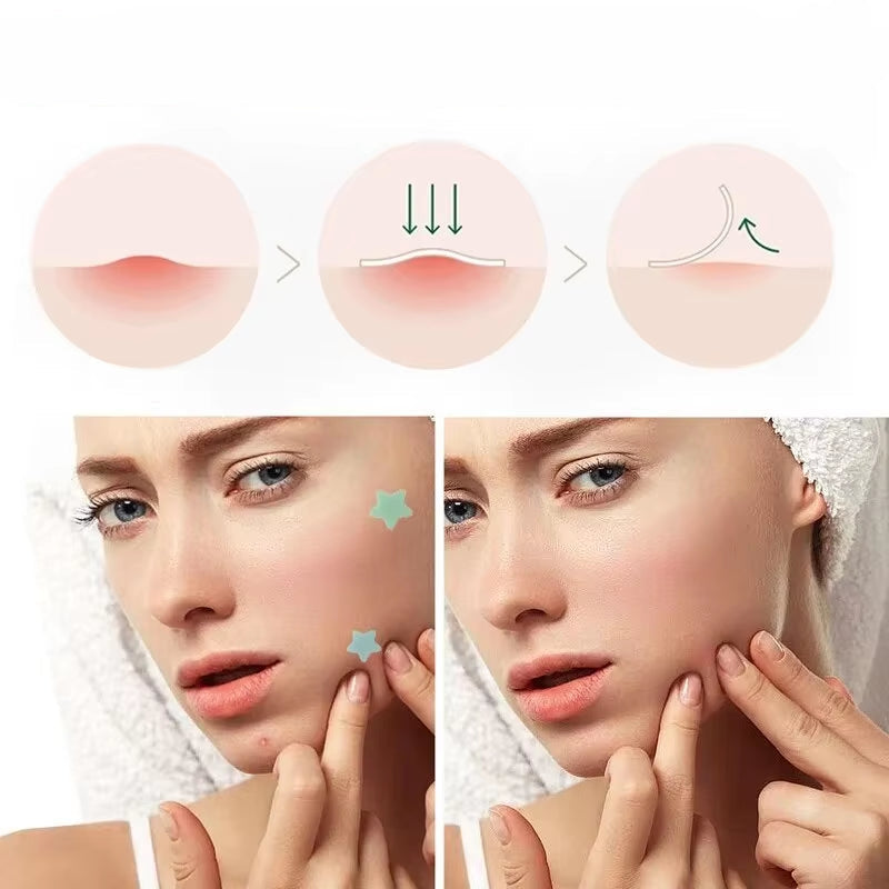 Repair Acne Patch Facial Skin Care Fade Blemishes Pimple Marks Closed Acne Blemishes Cover Acne Pimple Repair Patch